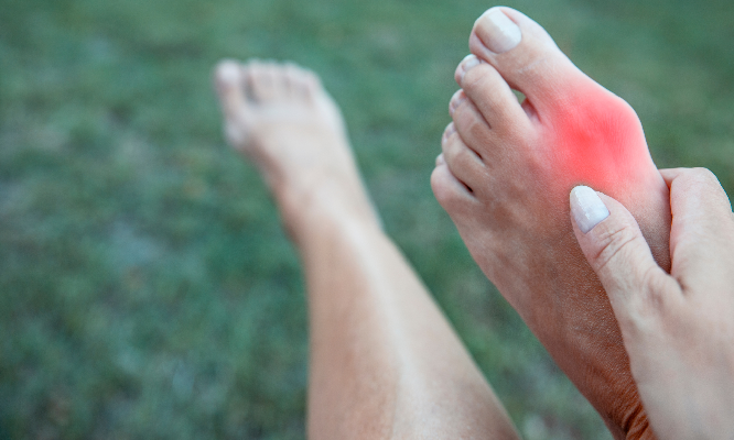 7 Common Symptoms of Bunions